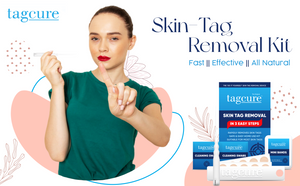 Tagcure - Skin Tag Removal Device