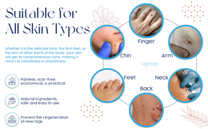 Tagcure - Skin Tag Removal Device