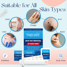 Load image into Gallery viewer, Tagcure - Skin Tag Removal Device
